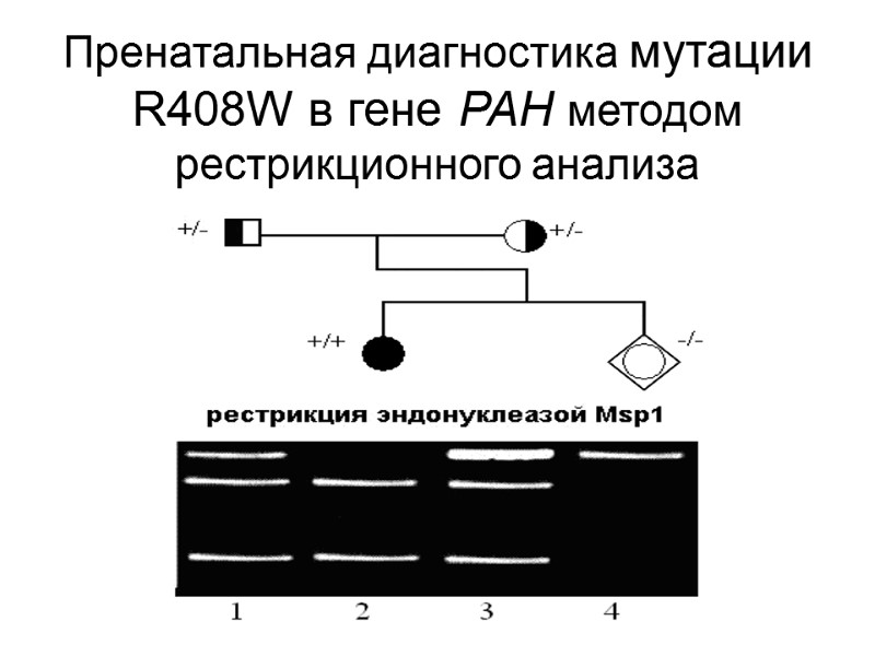 Пренатальная диагностика мутации   R408W в гене PAH методом рестрикционного анализа